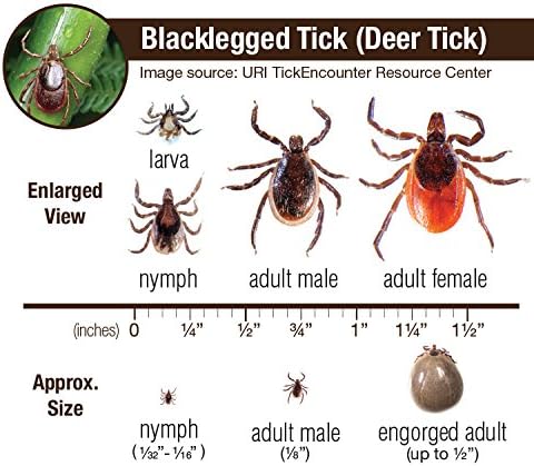 eTradewinds Tick Remover Tool Kit Tweezers & Tick Identifier Card - Hygienic All Stainless Steel Tick Removal Instrument Ideal for Human, Dog, Cat & General Pet Tick Puller w/Leather Case