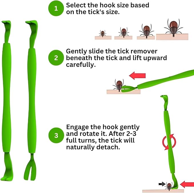 Tick Remover Tool - Safe & Easy Tick Remover for Humans and Pets - Effective Tick Remover for Cats and Dogs - Small to XL Tick Removal Tool for Dogs - Twist & Pull Tick Removal Kit (Set of 5)